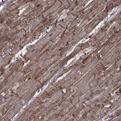 Integrin alpha 7 Antibody, Novus Biologicals:Antibodies:Primary Antibodies